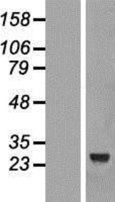 Western Blot: CCDC103 Overexpression Lysate (Adult Normal) [NBL1-08761] Left-Empty vector transfected control cell lysate (HEK293 cell lysate); Right -Over-expression Lysate for CCDC103.