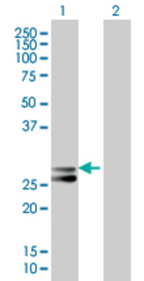 Lane 1: GZMK transfected lysate (29.15 KDa). Lane 2: Non-transfected lysate.