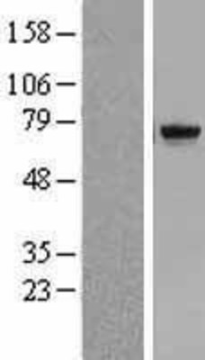 Western Blot: TDP1 Overexpression Lysate (Adult Normal) [NBL1-16800] Left-Empty vector transfected control cell lysate (HEK293 cell lysate); Right -Over-expression Lysate for TDP1.