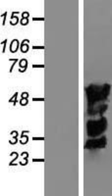Western Blot: IRF4 Overexpression Lysate (Adult Normal) [NBL1-12033] Left-Empty vector transfected control cell lysate (HEK293 cell lysate); Right -Over-expression Lysate for IRF4.