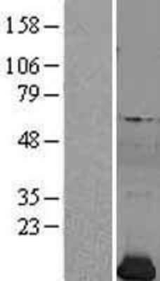 Western Blot: Profilin 2 Overexpression Lysate (Adult Normal) [NBL1-14319] Left-Empty vector transfected control cell lysate (HEK293 cell lysate); Right -Over-expression Lysate for Profilin 2.