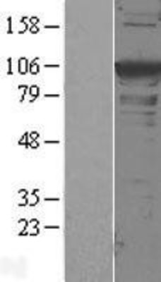 Western Blot: Alpha Actinin 1 Overexpression Lysate (Adult Normal) [NBL1-07282] Left-Empty vector transfected control cell lysate (HEK293 cell lysate); Right -Over-expression Lysate for Alpha Actinin 1.