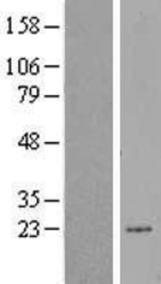 Western Blot: ERCC8 Overexpression Lysate (Adult Normal) [NBL1-10324] Left-Empty vector transfected control cell lysate (HEK293 cell lysate); Right -Over-expression Lysate for ERCC8.