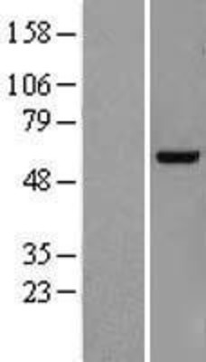 Western Blot: KDELC2 Overexpression Lysate (Adult Normal) [NBL1-12219] Left-Empty vector transfected control cell lysate (HEK293 cell lysate); Right -Over-expression Lysate for KDELC2.