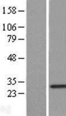 Western Blot: RNF141 Overexpression Lysate (Adult Normal) [NBL1-15426] Left-Empty vector transfected control cell lysate (HEK293 cell lysate); Right -Over-expression Lysate for RNF141.