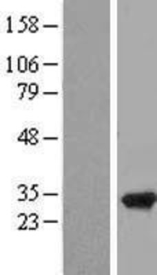 Western Blot: RPAIN Overexpression Lysate (Adult Normal) [NBL1-15492] Left-Empty vector transfected control cell lysate (HEK293 cell lysate); Right -Over-expression Lysate for RPAIN.