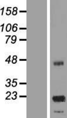Western Blot: ASPDH Overexpression Lysate (Adult Normal) [NBL1-12619] Left-Empty vector transfected control cell lysate (HEK293 cell lysate); Right -Over-expression Lysate for ASPDH.