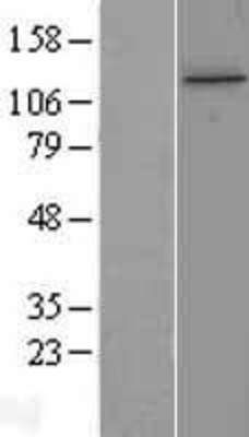 Western Blot: TTI1 Overexpression Lysate (Adult Normal) [NBL1-12245] Left-Empty vector transfected control cell lysate (HEK293 cell lysate); Right -Over-expression Lysate for TTI1.