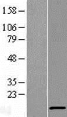 Western Blot: V-type proton ATPase subunit F Overexpression Lysate (Adult Normal) [NBL1-07845] Left-Empty vector transfected control cell lysate (HEK293 cell lysate); Right -Over-expression Lysate for V-type proton ATPase subunit F.