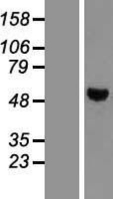 Western Blot: PTPN1 Overexpression Lysate (Adult Normal) [NBL1-14967] Left-Empty vector transfected control cell lysate (HEK293 cell lysate); Right -Over-expression Lysate for PTPN1.