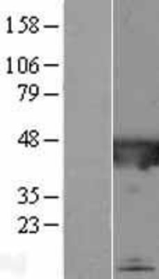 Western Blot: C2orf62 Overexpression Lysate (Adult Normal) [NBL1-08424] Left-Empty vector transfected control cell lysate (HEK293 cell lysate); Right -Over-expression Lysate for C2orf62.