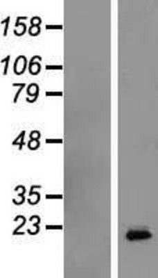 Western Blot: Human Growth Hormone Overexpression Lysate (Adult Normal) [NBL1-11063] Left-Empty vector transfected control cell lysate (HEK293 cell lysate); Right -Over-expression Lysate for Human Growth Hormone.