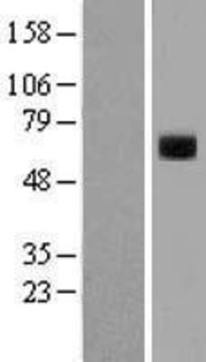 Western Blot: Tissue Plasminogen Activator Overexpression Lysate (Adult Normal) [NBL1-14484] Left-Empty vector transfected control cell lysate (HEK293 cell lysate); Right -Over-expression Lysate for Tissue Plasminogen Activator.