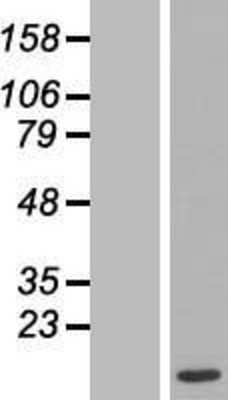 Western Blot: MAX Overexpression Lysate (Adult Normal) [NBL1-12920] Left-Empty vector transfected control cell lysate (HEK293 cell lysate); Right -Over-expression Lysate for MAX.