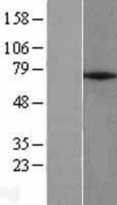 Western Blot: ZNF354A Overexpression Lysate (Adult Normal) [NBL1-18130] Left-Empty vector transfected control cell lysate (HEK293 cell lysate); Right -Over-expression Lysate for ZNF354A.
