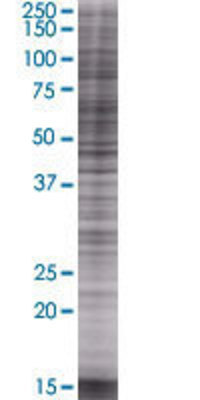 TREM2 transfected lysate.