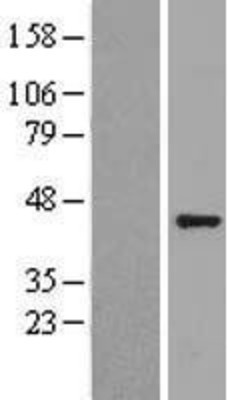 Western Blot: GNAQ Overexpression Lysate (Adult Normal) [NBL1-11159] Left-Empty vector transfected control cell lysate (HEK293 cell lysate); Right -Over-expression Lysate for GNAQ.