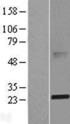 Western Blot: ABHD14B Overexpression Lysate (Adult Normal) [NBL1-07194] Left-Empty vector transfected control cell lysate (HEK293 cell lysate); Right -Over-expression Lysate for ABHD14B.