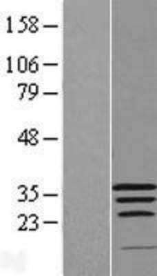 Western Blot: WIBG Overexpression Lysate (Adult Normal) [NBL1-17850] Left-Empty vector transfected control cell lysate (HEK293 cell lysate); Right -Over-expression Lysate for WIBG.