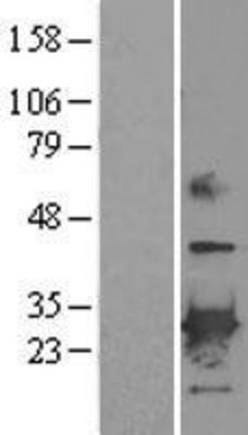Western Blot: Peroxiredoxin-6 Overexpression Lysate (Adult Normal) [NBL1-14743] Left-Empty vector transfected control cell lysate (HEK293 cell lysate); Right -Over-expression Lysate for Peroxiredoxin-6.
