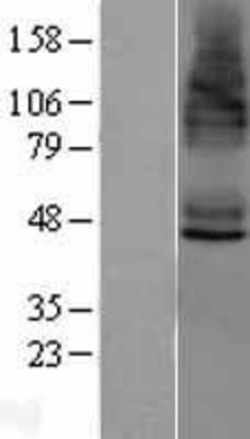 Western Blot: STEAP4 Overexpression Lysate (Adult Normal) [NBL1-16537] Left-Empty vector transfected control cell lysate (HEK293 cell lysate); Right -Over-expression Lysate for STEAP4.