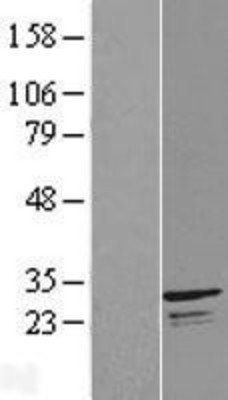 Western Blot: INF2 Overexpression Lysate (Adult Normal) [NBL1-08180] Left-Empty vector transfected control cell lysate (HEK293 cell lysate); Right -Over-expression Lysate for INF2.