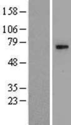 Western Blot: CHST15 Overexpression Lysate (Adult Normal) [NBL1-10951] Left-Empty vector transfected control cell lysate (HEK293 cell lysate); Right -Over-expression Lysate for CHST15.