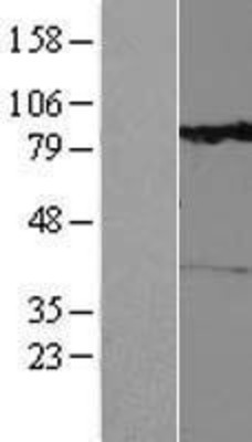 Western Blot: RHOBTB1 Overexpression Lysate (Adult Normal) [NBL1-15352] Left-Empty vector transfected control cell lysate (HEK293 cell lysate); Right -Over-expression Lysate for RHOBTB1.