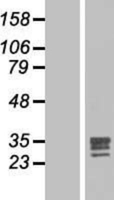 Western Blot: FGF17 Overexpression Lysate (Adult Normal) [NBL1-10691] Left-Empty vector transfected control cell lysate (HEK293 cell lysate); Right -Over-expression Lysate for FGF17.