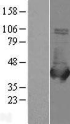 Western Blot: Aldolase B Overexpression Lysate (Adult Normal) [NBL1-07462] Left-Empty vector transfected control cell lysate (HEK293 cell lysate); Right -Over-expression Lysate for Aldolase B.