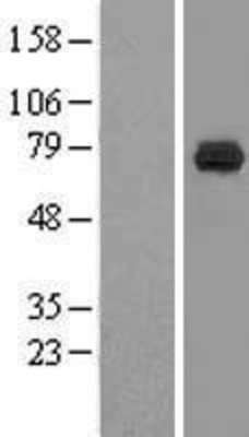 Western Blot: DCP1B Overexpression Lysate (Adult Normal) [NBL1-09746] Left-Empty vector transfected control cell lysate (HEK293 cell lysate); Right -Over-expression Lysate for DCP1B.