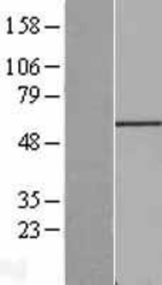 Western Blot: FGR Overexpression Lysate (Adult Normal) [NBP2-09245] Left-Empty vector transfected control cell lysate (HEK293 cell lysate); Right -Over-expression Lysate for FGR.