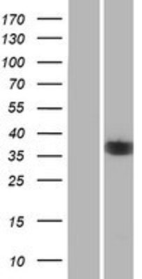 Western Blot: NEK6 Overexpression Lysate (Adult Normal) [NBP2-10144] Left-Empty vector transfected control cell lysate (HEK293 cell lysate); Right -Over-expression Lysate for NEK6.