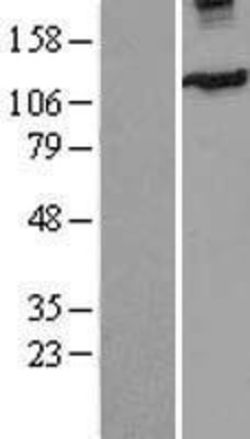 Western Blot: Eg5 Overexpression Lysate (Adult Normal) [NBL1-12284] Left-Empty vector transfected control cell lysate (HEK293 cell lysate); Right -Over-expression Lysate for Eg5.