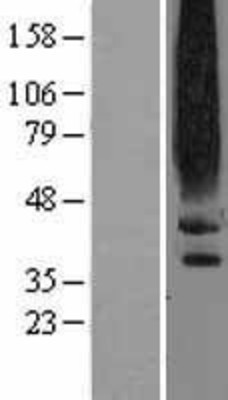 Western Blot: Dopamine D2 Receptor Overexpression Lysate (Adult Normal) [NBL1-10016] Left-Empty vector transfected control cell lysate (HEK293 cell lysate); Right -Over-expression Lysate for Dopamine D2 Receptor.