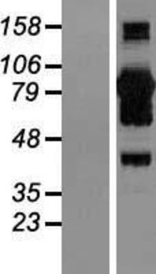 Western Blot: CoCoA Overexpression Lysate (Adult Normal) [NBL1-08645] Left-Empty vector transfected control cell lysate (HEK293 cell lysate); Right -Over-expression Lysate for CoCoA.