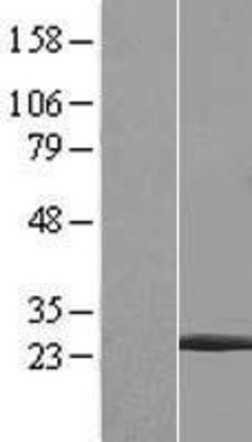 Western Blot: CENPM Overexpression Lysate (Adult Normal) [NBL1-09088] Left-Empty vector transfected control cell lysate (HEK293 cell lysate); Right -Over-expression Lysate for CENPM.