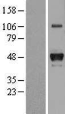 Western Blot: Haptoglobin Overexpression Lysate (Adult Normal) [NBL1-11686] Left-Empty vector transfected control cell lysate (HEK293 cell lysate); Right -Over-expression Lysate for Haptoglobin.