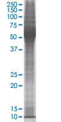 TUBB2A transfected lysate