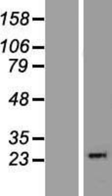 Western Blot: THYN1 Overexpression Lysate (Adult Normal) [NBP2-10097] Left-Empty vector transfected control cell lysate (HEK293 cell lysate); Right -Over-expression Lysate for THYN1.