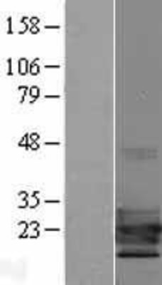 Western Blot: TCF21 Overexpression Lysate (Adult Normal) [NBP2-10082] Left-Empty vector transfected control cell lysate (HEK293 cell lysate); Right -Over-expression Lysate for TCF21.