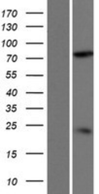 Western Blot: DDHD2 Overexpression Lysate (Adult Normal) [NBP2-10159] Left-Empty vector transfected control cell lysate (HEK293 cell lysate); Right -Over-expression Lysate for DDHD2.