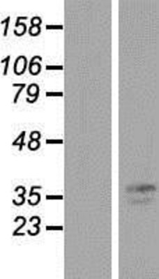Western Blot: TMPRSS3 Overexpression Lysate (Adult Normal) [NBP2-09933] Left-Empty vector transfected control cell lysate (HEK293 cell lysate); Right -Over-expression Lysate for TMPRSS3.