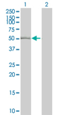 Lane 1: TUBB2A transfected lysate (49.06 KDa). Lane 2: Non-transfected lysate.