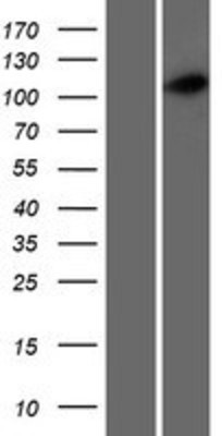 Western Blot: CCDC39 Overexpression Lysate (Adult Normal) [NBP2-10044] Left-Empty vector transfected control cell lysate (HEK293 cell lysate); Right -Over-expression Lysate for CCDC39.
