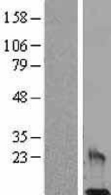 Western Blot: Resistin Overexpression Lysate (Adult Normal) [NBL1-15287] Left-Empty vector transfected control cell lysate (HEK293 cell lysate); Right -Over-expression Lysate for Resistin.