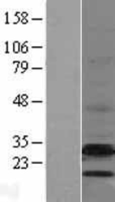 Western Blot: EBP Overexpression Lysate (Adult Normal) [NBL1-10094] Left-Empty vector transfected control cell lysate (HEK293 cell lysate); Right -Over-expression Lysate for EBP.