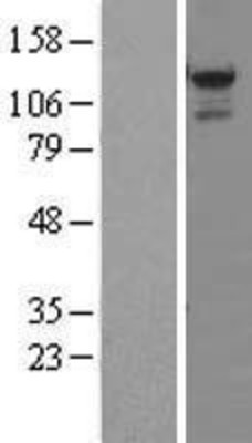 Western Blot: STK31 Overexpression Lysate (Adult Normal) [NBL1-16548] Left-Empty vector transfected control cell lysate (HEK293 cell lysate); Right -Over-expression Lysate for STK31.