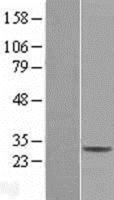 Western Blot: CD99L2 Overexpression Lysate (Adult Normal) [NBL1-08986] Left-Empty vector transfected control cell lysate (HEK293 cell lysate); Right -Over-expression Lysate for CD99L2.