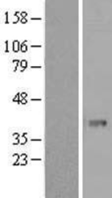 Western Blot: PHF11 Overexpression Lysate (Adult Normal) [NBL1-14353] Left-Empty vector transfected control cell lysate (HEK293 cell lysate); Right -Over-expression Lysate for PHF11.
